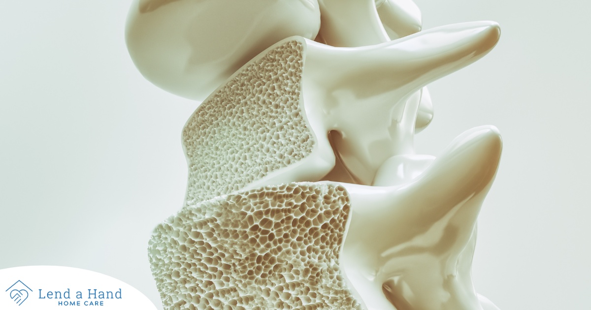 An image of a spine with the inside exposed represents osteoporosis.